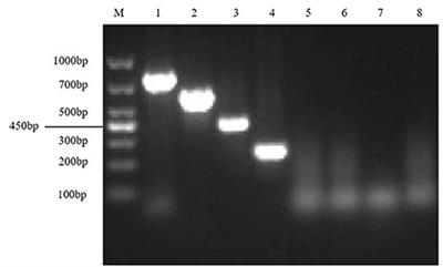 Development of a multiplex RT-PCR method for the detection of four porcine enteric coronaviruses